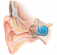 Cochlear Implants in Allahabad at Shanti Vilas ENT Clinic